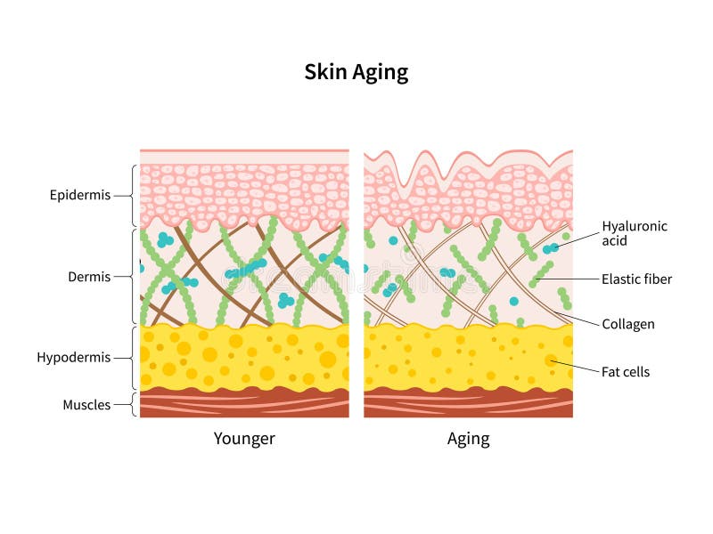 Alt Image